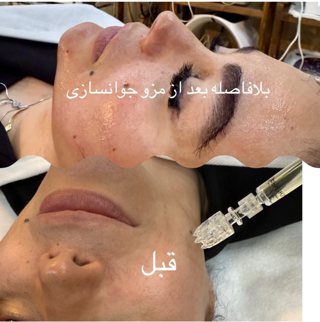 مزو ام دی 2 IMG 2976 min
