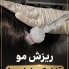 درمان ریزش مو